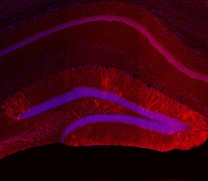 Red staining indicates expression of Kir2.1 potassium ion channels in dentate gyrus engram cells in the hippocampus of the brain.