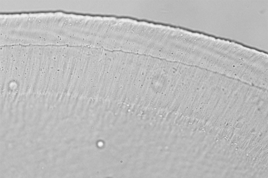This image, taken through an optical microscope, shows a cross-section of the tectorial membrane, a gelatinous structure that lies atop the tiny hairs that line the inner ear.