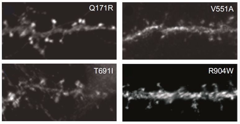 Some variants of the SYNE1 gene, such as V551A top right, reduced the ability of the protein CPG2, shown here as bright spots, to locate in protruding spines of dendrites that house excitatory synapses in the neurons of rats.
