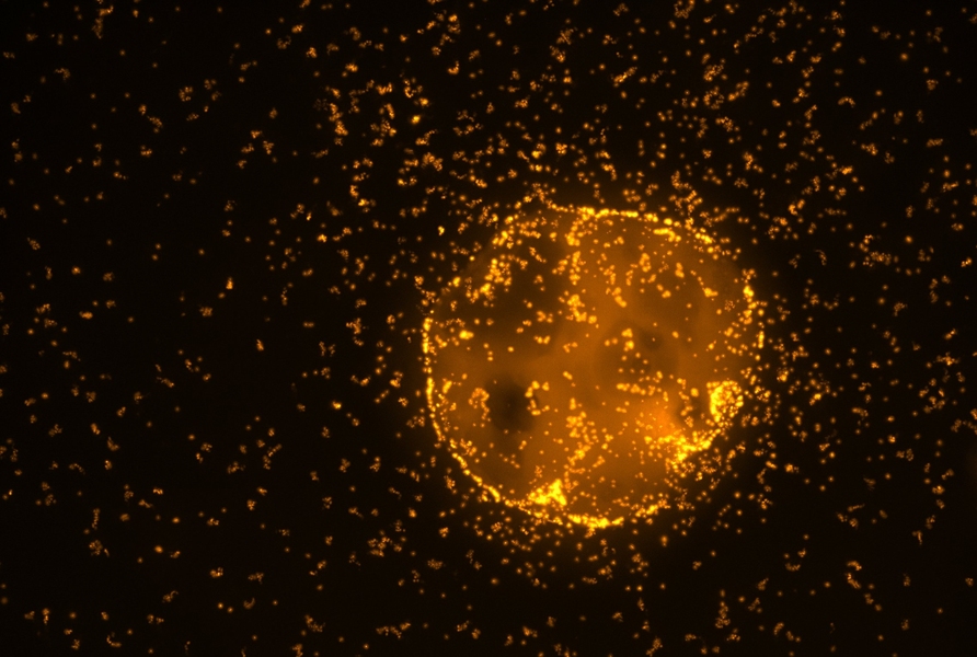 Microscopic particles were immersed in natural seawater and examined underneath the microscope in order to observe the colonization dynamics of bacteria using genome sequencing.