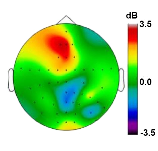 Researchers saw sharp increases in the power of theta frequency rhythms (warmer colors) in the frontal cortex as volunteers performed an experimental task.
