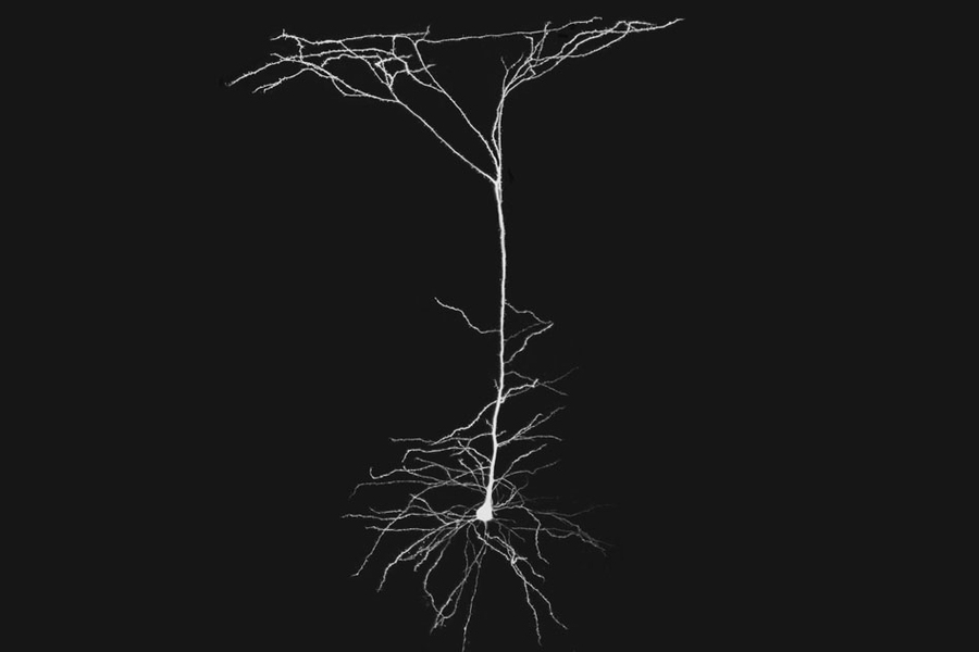 dendrite connections