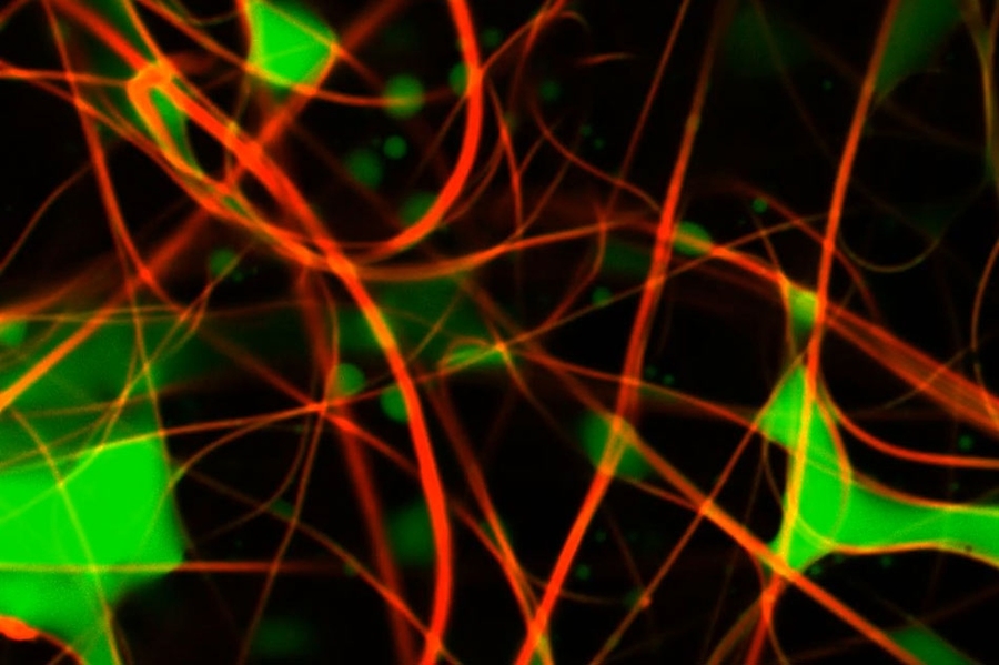 Image taken using the MIT researchers' system shows the fibers of the filter membrane in red, and the oily droplets accumulating on it in green. The colors results from fluorescent dyes added to the materials.