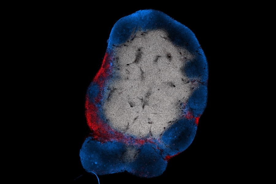 MIT engineers have devised a way to stimulate T cells (shown in red) to attack tumors by activating them with a vaccine that accumulates in the lymph nodes. B cells in the lymph nodes are labeled in blue.