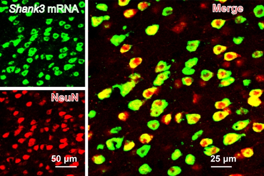 SHANK3 (green) is expressed along with a neural marker (NeuN) in the mouse anterior cingulate cortex.
