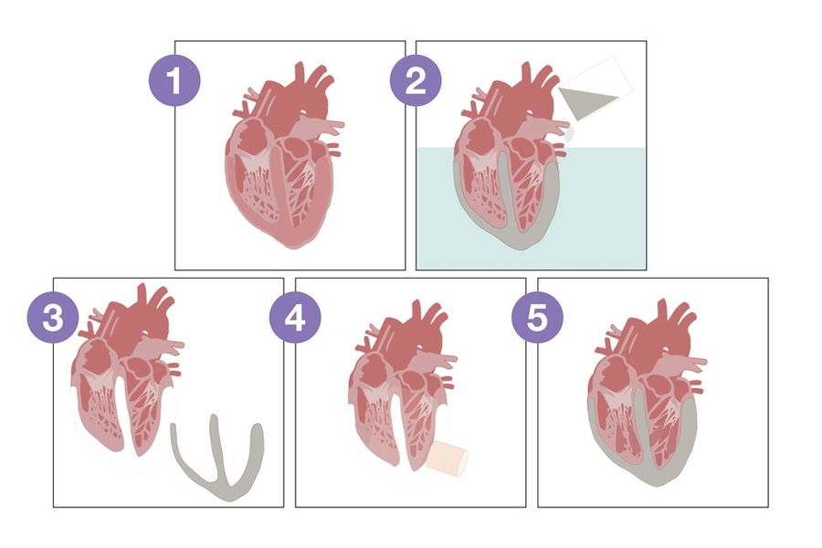 tissue heart valve