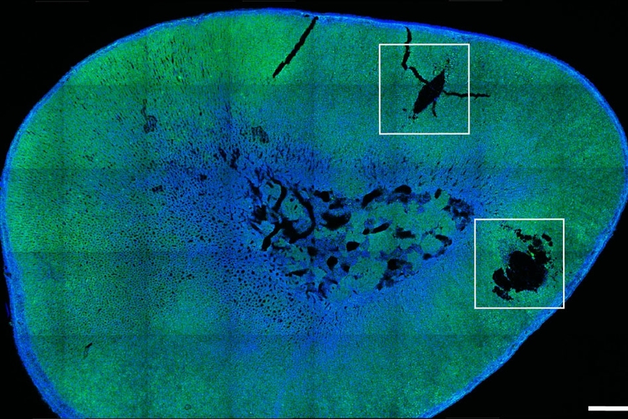 Researchers Achieve Remote Control Of Hormone Release Mit News Massachusetts Institute Of Technology