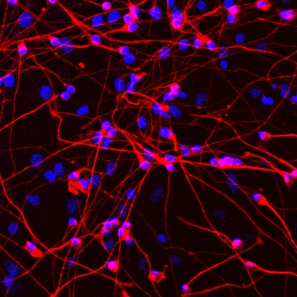 Immunofluorescence microscopy of MeCP2 neurons derived from mouse embryonic stem cells