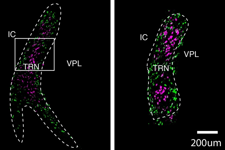 These cross-sections of the thalamic reticular nucleus (TRN) show two distinct populations of neurons, labeled in purple and green. A team of researchers from MIT and the Broad Institute of MIT and Harvard has now mapped the TRN in unprecedented detail.