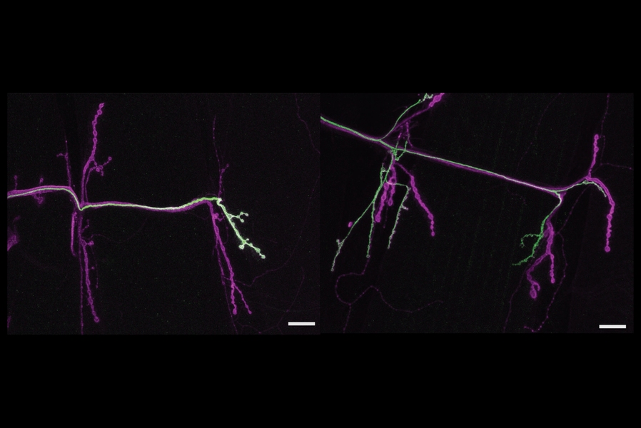 The left side shows a "tonic" neuron (stained green) growing to just one muscle on the right of the panel. In the next panel, one can see a "phasic" neuron (also stained green) connecting to more than one muscle.