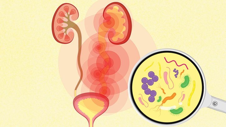Stylized illustration of microbes in a urinary tract