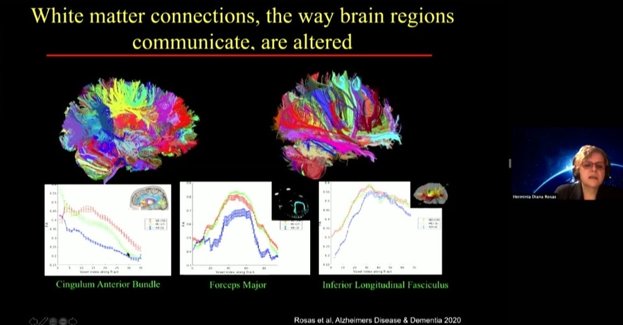 Image of two brains made of colorful lines side-by-side. A woman presenting the scans is pictured further to the right.