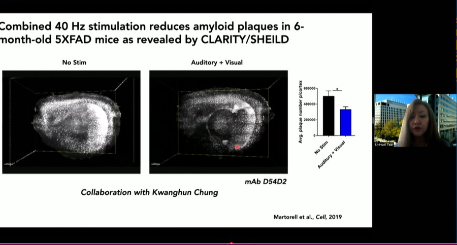 Two brain scans side by side show that one has more white spots than the other. To the right is a picture of Li-Huei Tsai presenting the scans