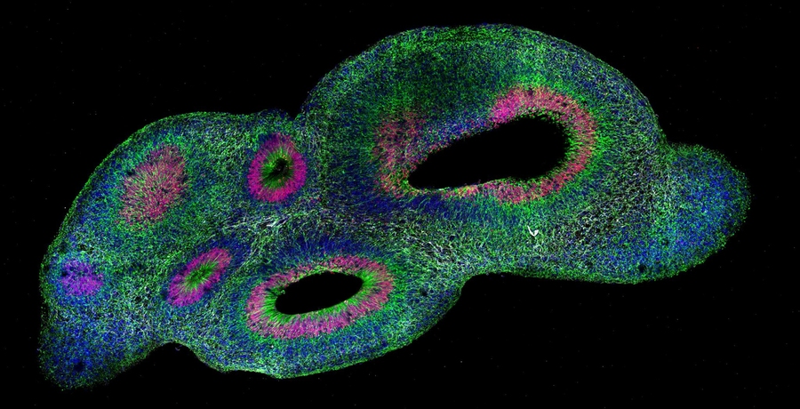 A 2D micrograph of an oblong organoid on a black background features thousands of spots of many different colors. There are also two large open spaces within the shape.