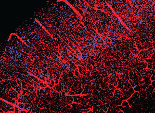 Micrograph of red branchy streaks oriented from top left to bottom right stretch across a field of blue dots over a black background