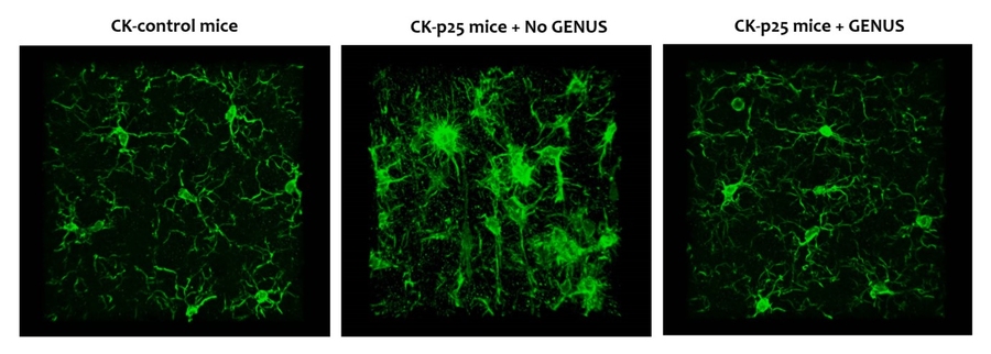 Three images of brain cells, all green on a black background. The central image has the densest, brightest green cells