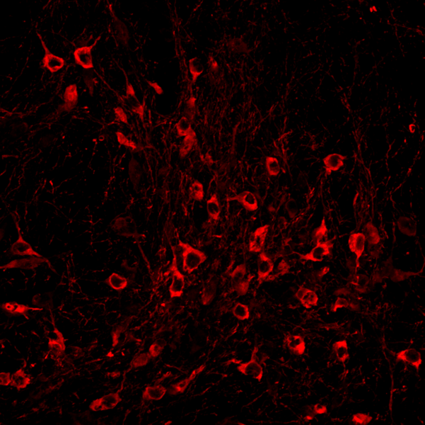 Micrograph of cells glowing reddish before a black background