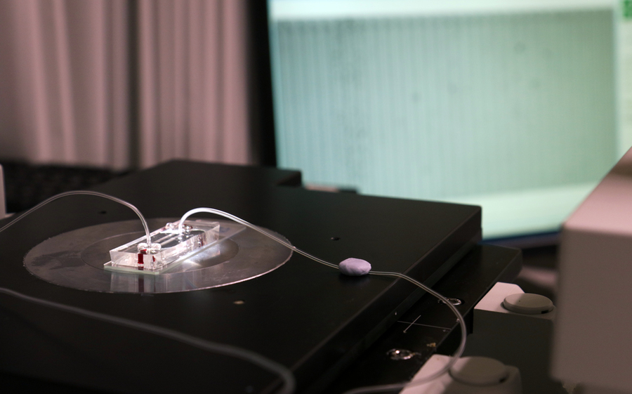 Photo of the microfluidic DLD assay chip with sample red dye loaded on a microscope stage.