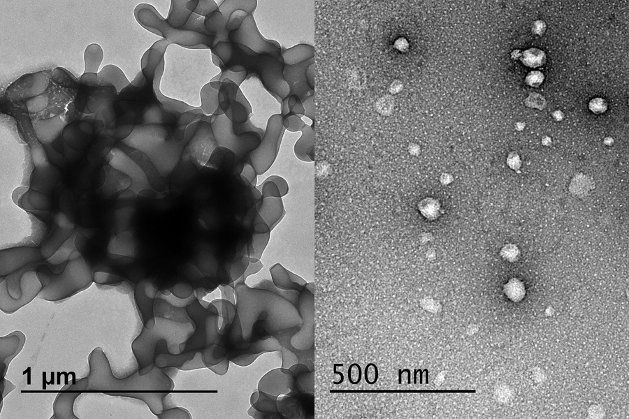 Split screen, all black and white: At left, a microscope image of a blobby cluster of what looks like cells; at right, a microscope image featuring discrete dots of varying size