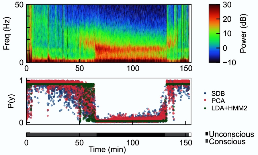 A rectangle along the top of this spectrogram uses colors to show the power of different frequencies of brain rhythms at different times. A bottom rectangle uses the height of dots to show how algorithms judged the probability of consciousness at those same times.