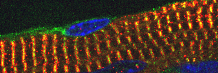 Long strand of orange segmented material on a black background, with blue ovals in several places