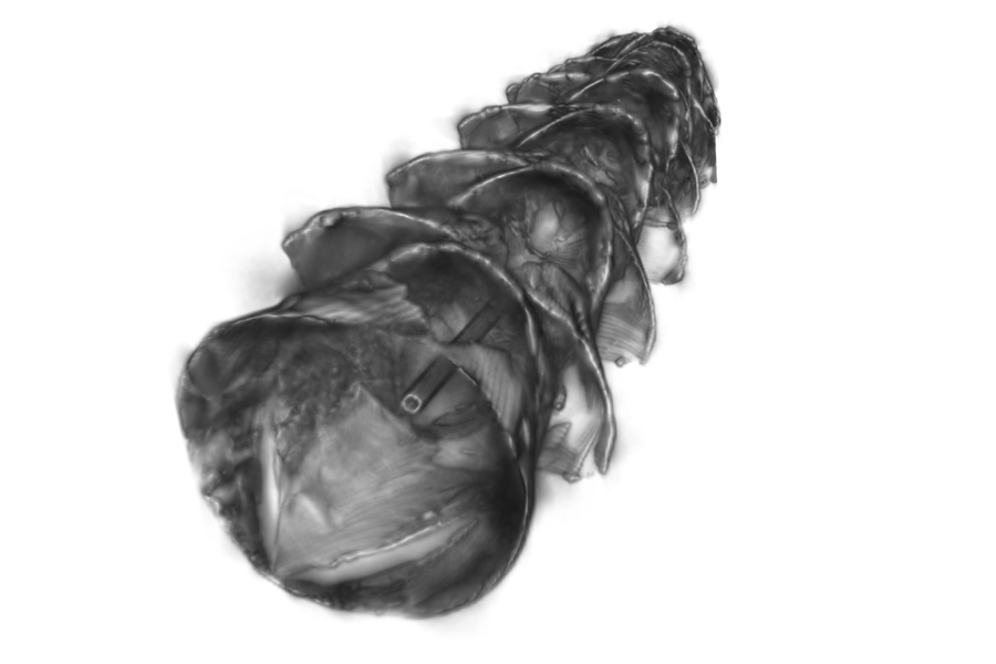 graphic of new stent