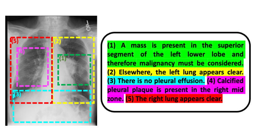Decoding Radiology: Navigating Insights from Medical Imaging Reports Decoding Radiology: Navigating Insights from Medical Imaging Reports