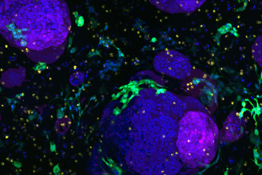daigram of pancreatic organoids