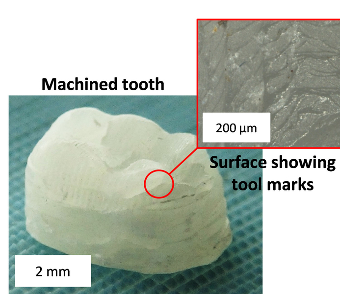 tooth composite
