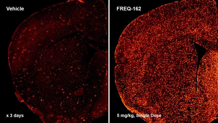 oligodendrocytes