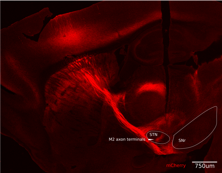 On a black background, long red streaks are visible leading from the upper left to the lower right. A white circle highlighs a small area labeled STN