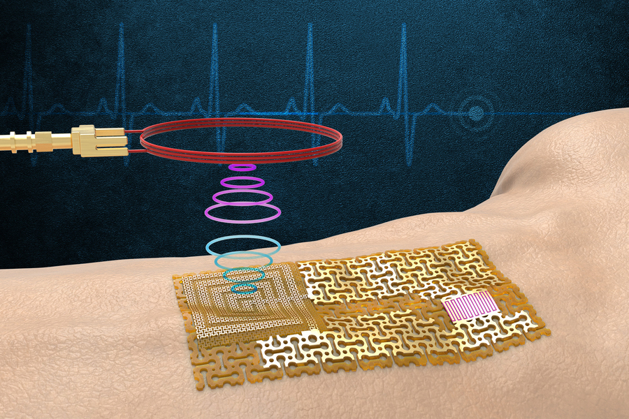 This illustration shows a device wirelessly transmitting signals to a chip-free patch on a person’s skin.