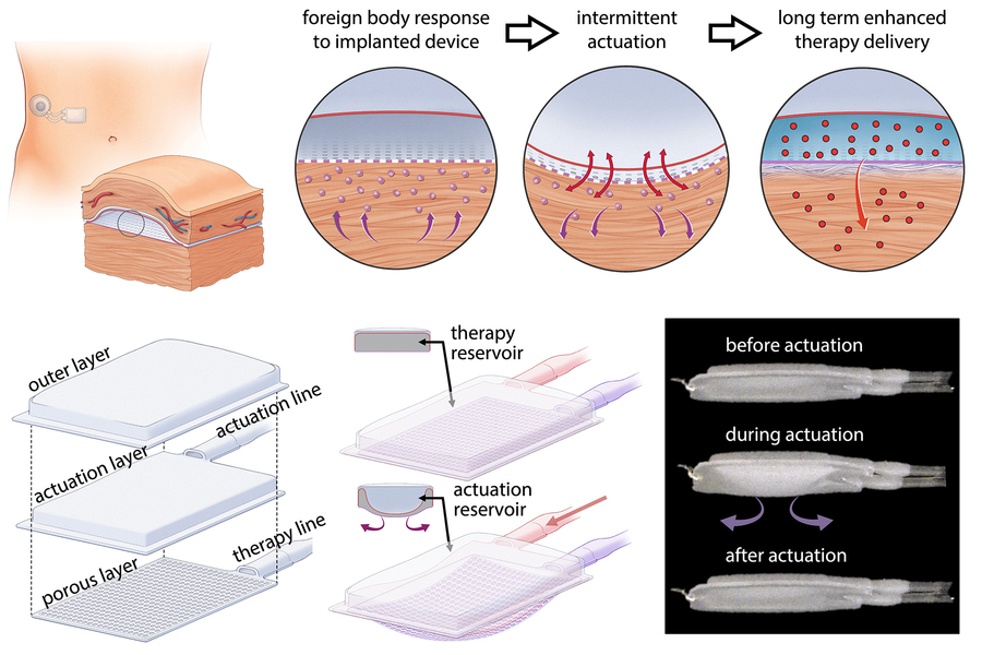 skin scar tissue