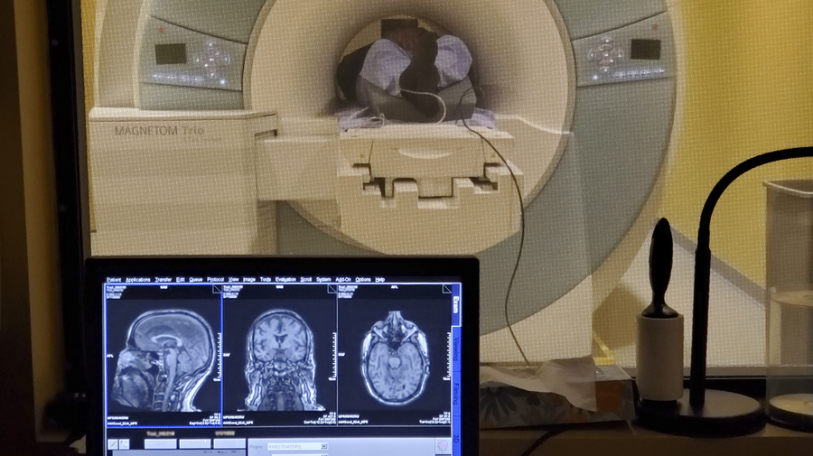 Small studies of 40-hertz sensory stimulation confirm safety