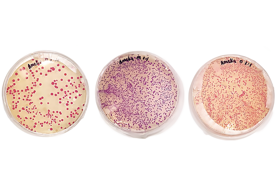 Photo of three glass petri dishes in which E.coli is being cultured. From left to right, the bacteria apear as coral, purple, and red dots.