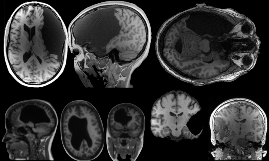 Eight anatomical brain scans in black-and-white, taken from various angles