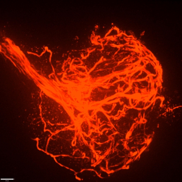 Scientists discover unique imaging technique to view synapse proteins