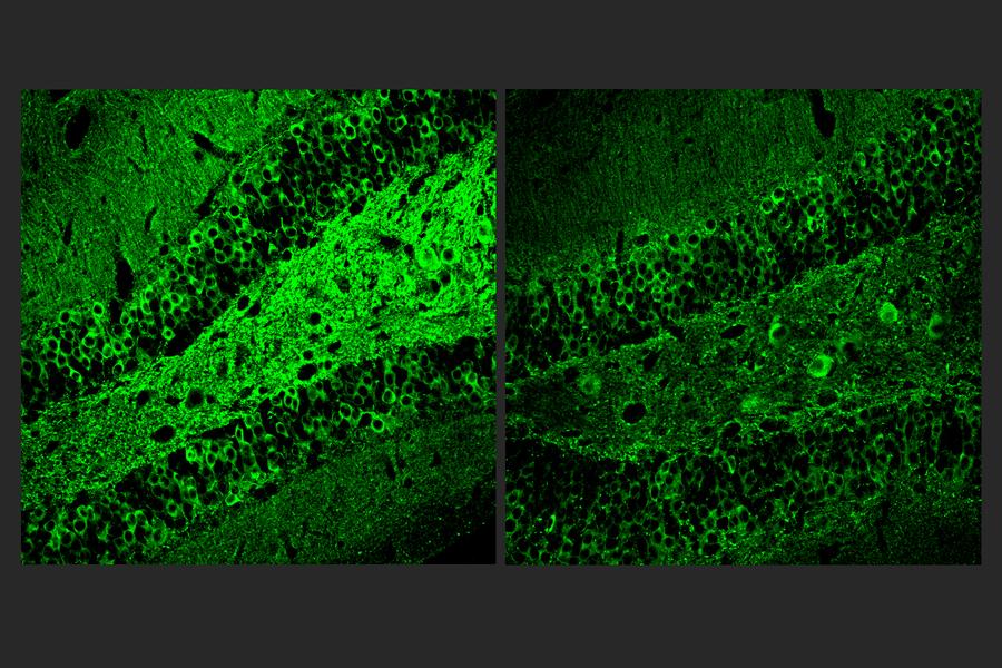 Two square panels side by side show similar swaths of brain tissue stained green on a black background. The left side is much brighter than the right.