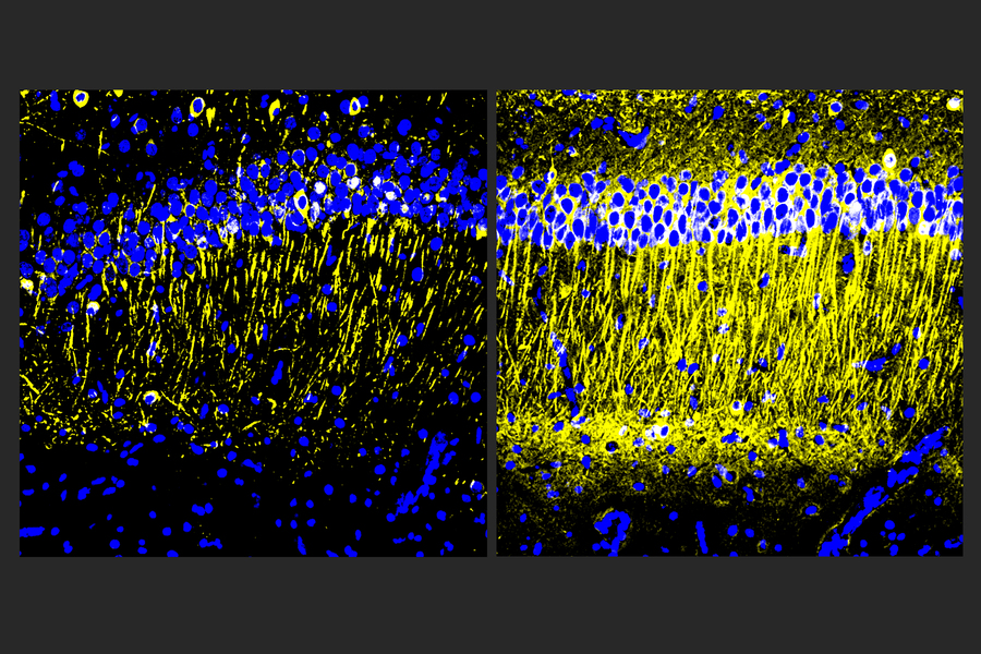 Two square panels side by side show similar swaths of brain tissue stained in blue and yellow on a black background. The right side has much more yellow than the right.