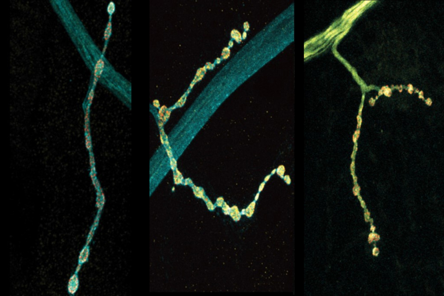 On a black background, three panels show a branch of a neuron where there is a thick main part and a thinner protrusion lined with little bulbs. The leftmost panel shows a gray main part with a somewhat yellow protrusion. The middle shows a grey thin part with a very yellow protrusion. In the right panel everything is very yellow.
