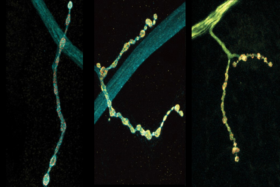 Individual neurons mix multiple RNA edits of key synapse protein, study  finds, MIT News