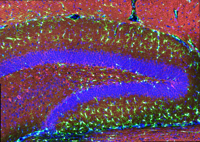 A colorfully stained section of a mouse hippocampus features scores of brightly glowing spiny-looking cells scattered throughout layers of tissue stained in blue and red
