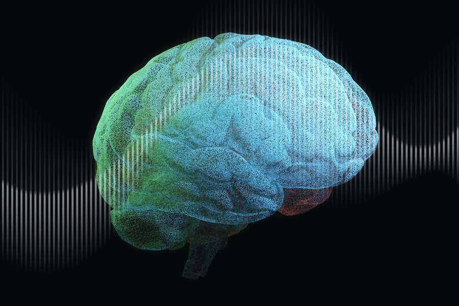 A bluish green brain illustrated against a black background has an overlay of a sound wave made of white bars.