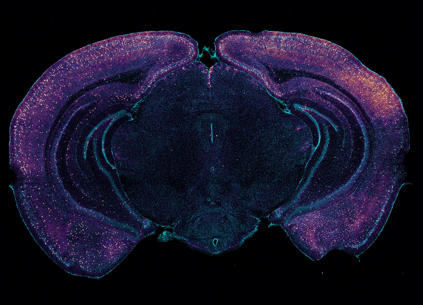 A coronal cross-section of a mouse brain is stained blue. The entire outer edge and occasional points further inside are speckled with yellow-green dots. 