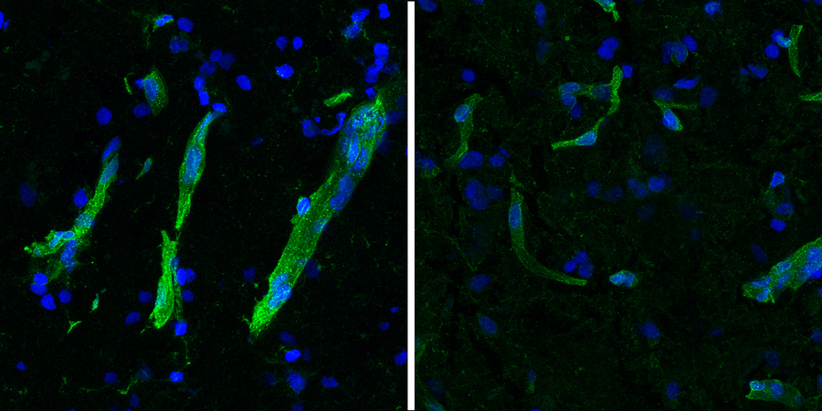 Two panels show diagonal streaks of green-stained brain blood vessels over a background of blue cells. The green staining is much brighter in the left panel than in the right.