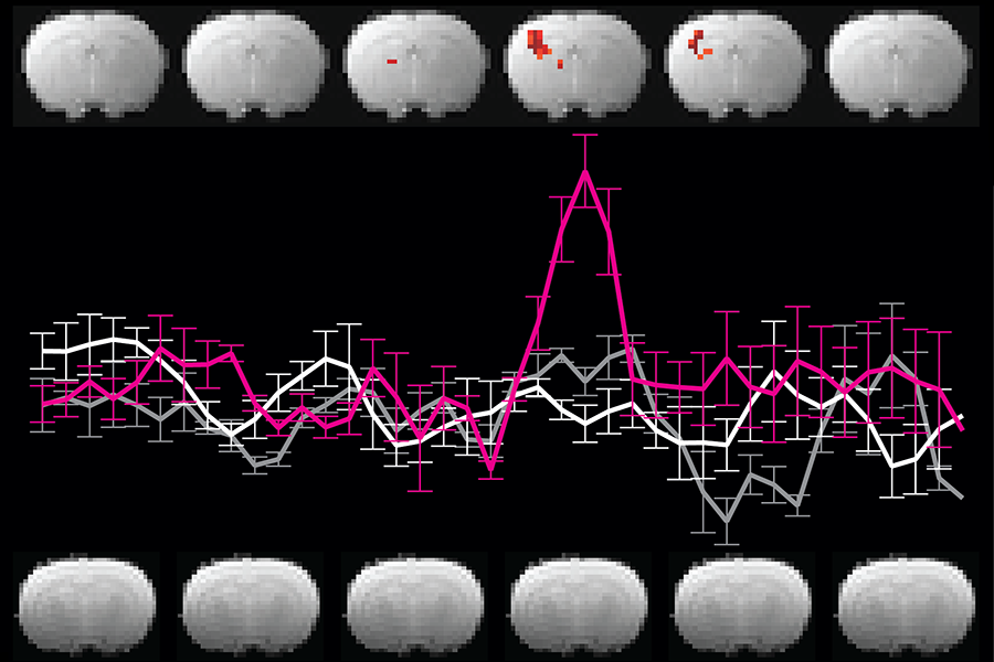 Two rows of MRI brain scans with a line graph in between. Several scans show small blobs of red. In the graph there is a spike corresponding to the brain scan with the largest red spot