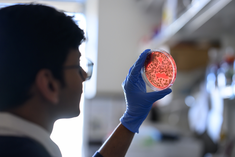 Ashutash Kumar, seen in silhouette from over the shoulder, studies a petri dish