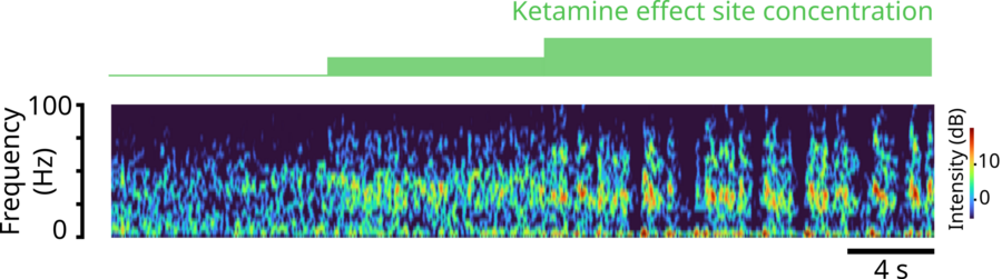 A very horizontal chart plots brain rhythm frequency over time with colors indicating power. Bars along the top indicate the dose of ketamine. After the dose starts more gamma frequency power appears. After the dose gets even higher, the gamma waves periodically stop and then resume.