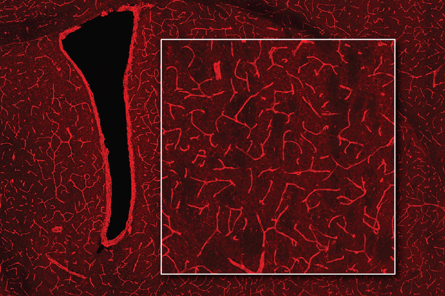 A MRI image of a brain shows bright red blood vessels on a darker red background.