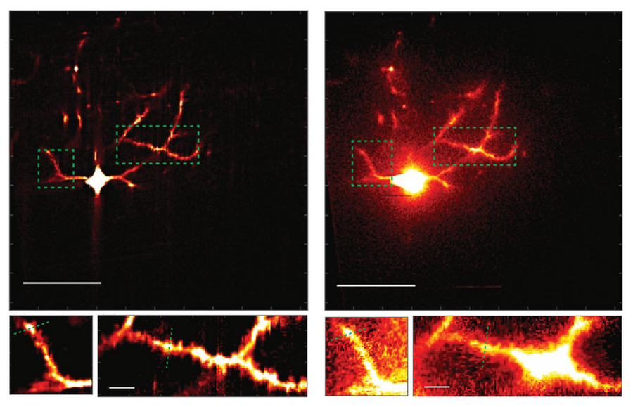 Four panels show a neuron glowing in red and yellow. The top left panel shows a neuron looing pretty sharp. Below that are zoomed in sections also looking detailed. On the right is a neuron that looks hazy. Below that are zoomed in sections that are also clouded.